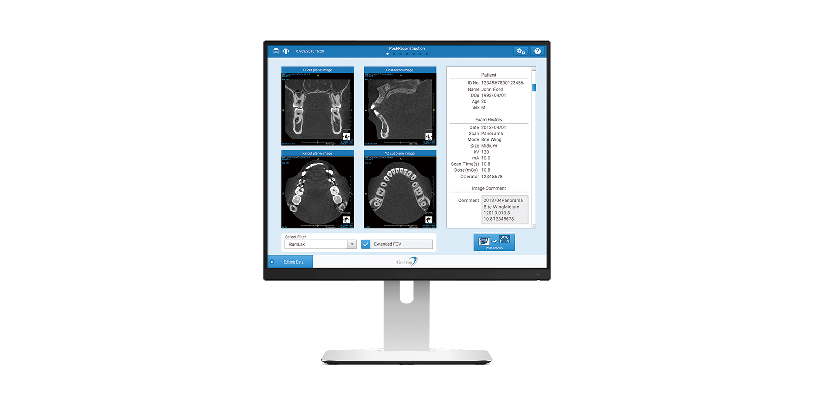 PreXison3D Excelsior